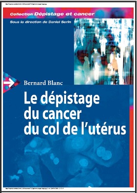 Le dépistage du cancer du col de l’utérus