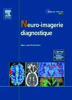 Neuro-imagerie diagnostique
