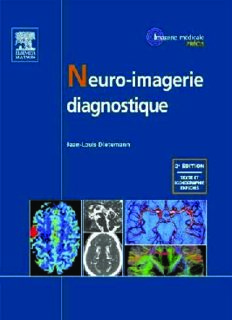Neuro-imagerie diagnostique