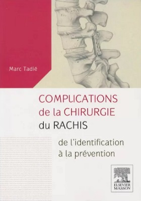 Complications de la chirurgie du rachis: De l’identification à la prévention
