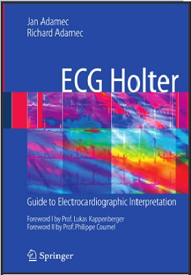 ECG Holter: Guide to Electrocardiographic Interpretation