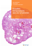 Actualités thérapeutiques dans les lymphomes