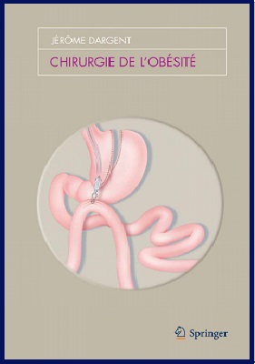 Chirurgie de l’obésité