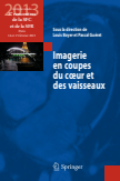 Imagerie en coupes du cœur et des vaisseaux